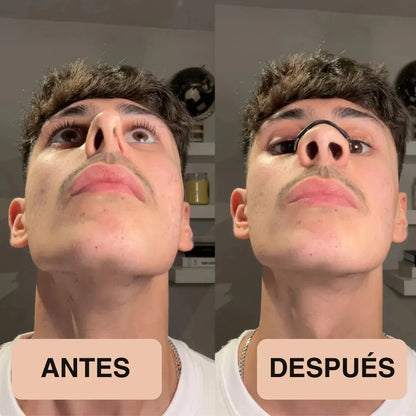Tiras Nasales Magnéticas